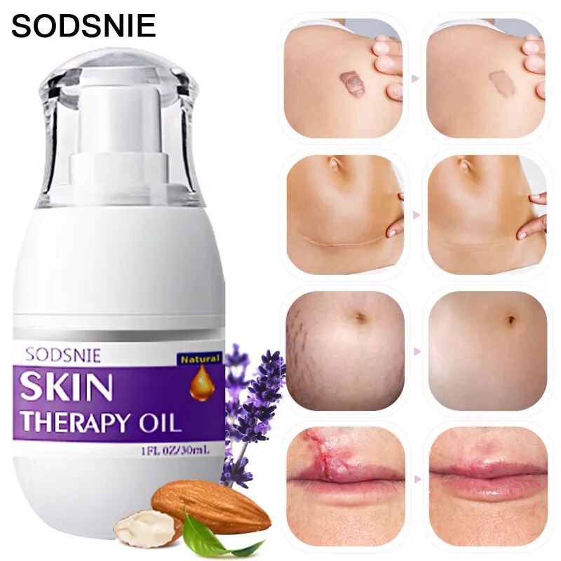 Skin Therapy Oil - Remove Cellulite, Stretch Marks, Surgical Scars, Burns Anit-Aging Skin Care 30ml