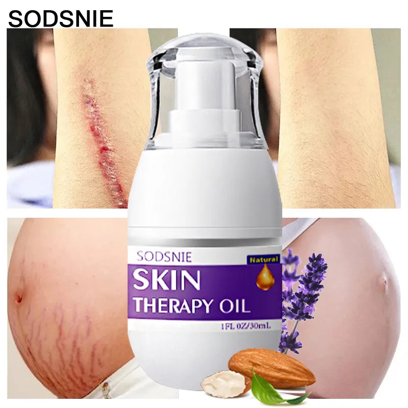 Skin Therapy Oil - Remove Cellulite, Stretch Marks, Surgical Scars, Burns Anit-Aging Skin Care 30ml