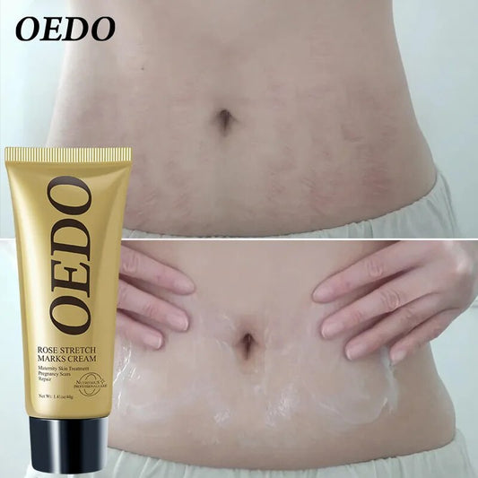 OEDO Rose Skin Care Cream - Restore Skin Elasticity, Promotes Cell Regeneration, Repair Stretch Marks